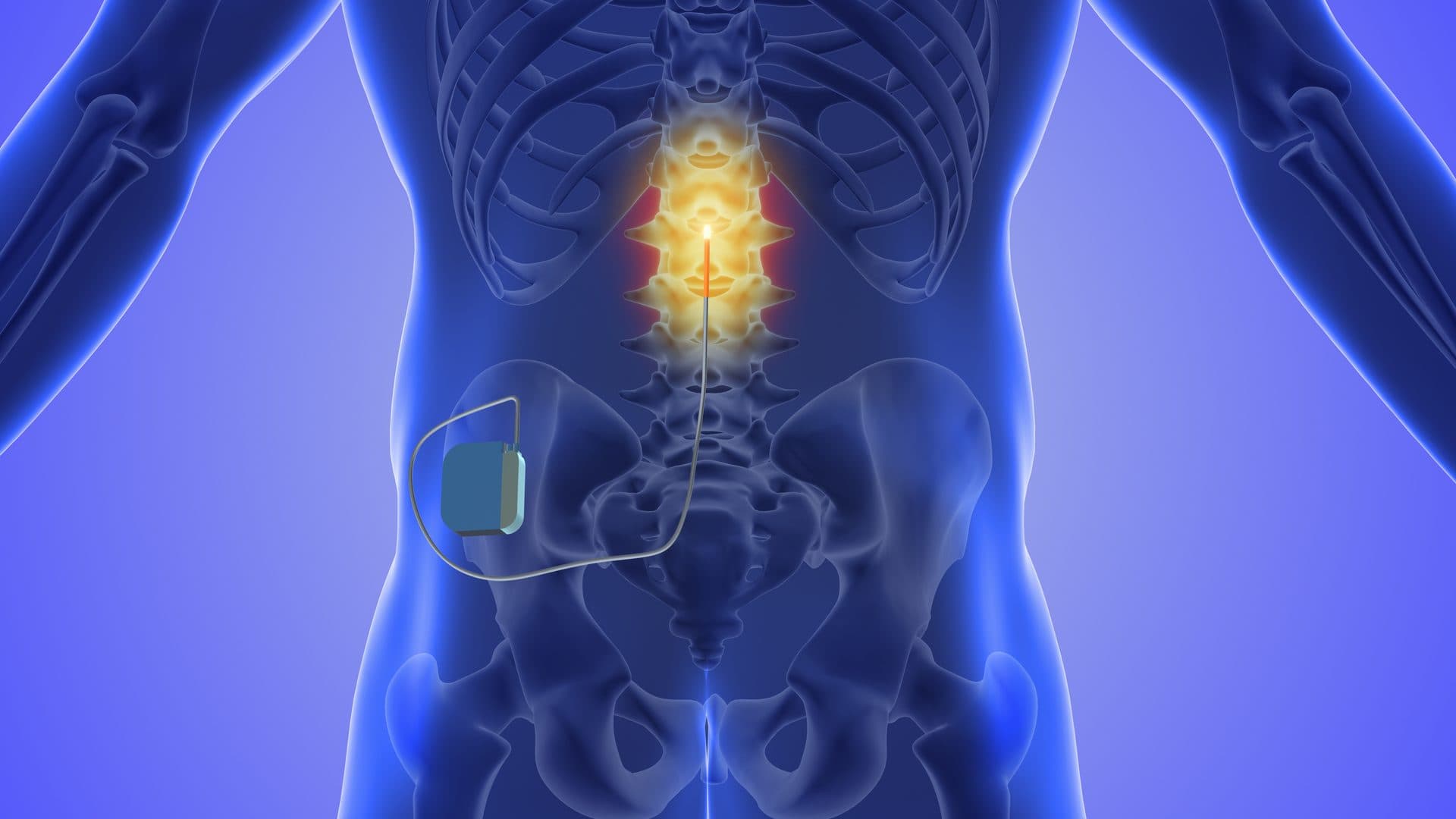 Spinal Cord & Peripheral Neuromodulation