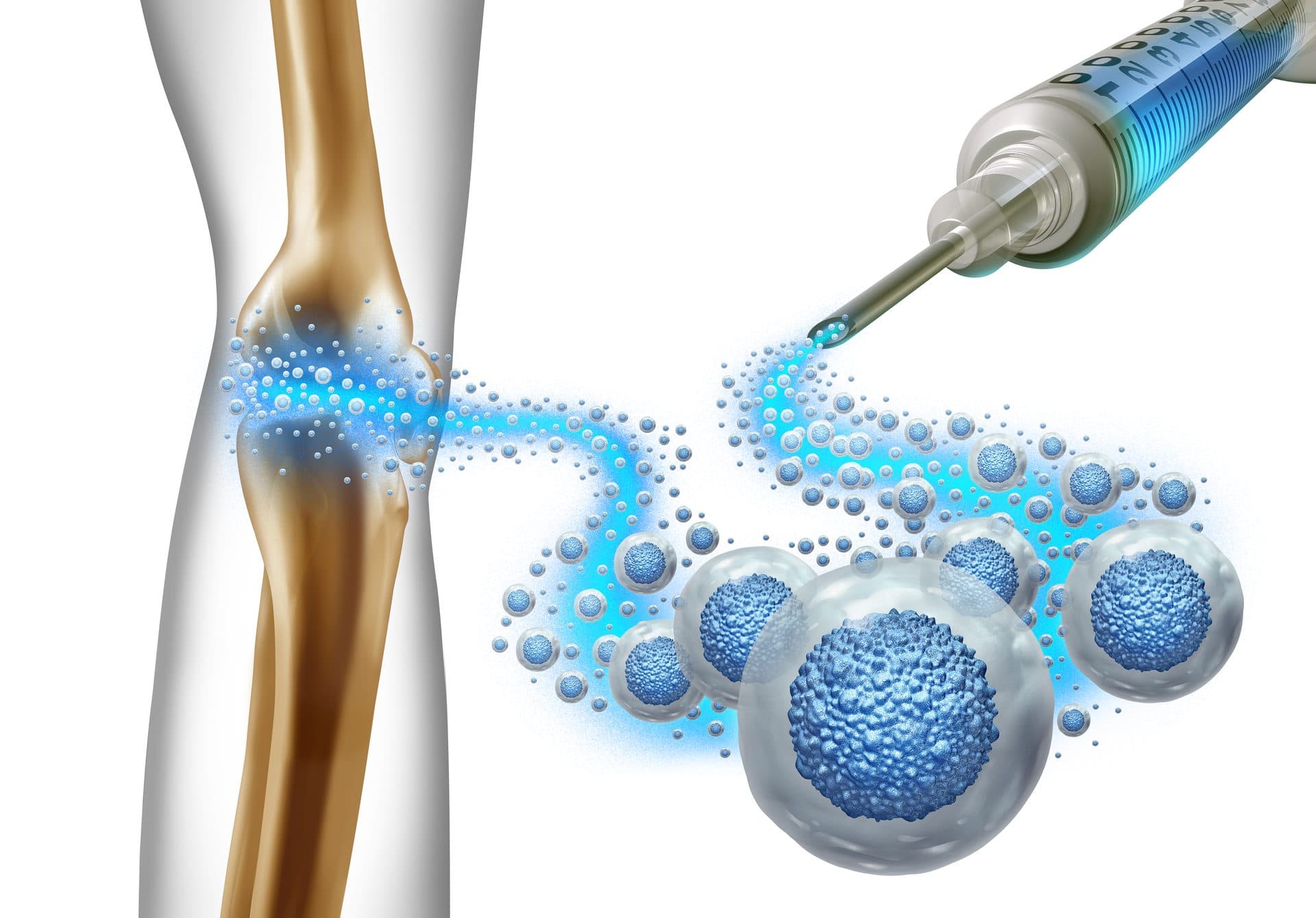 Stem cell therapy treatment